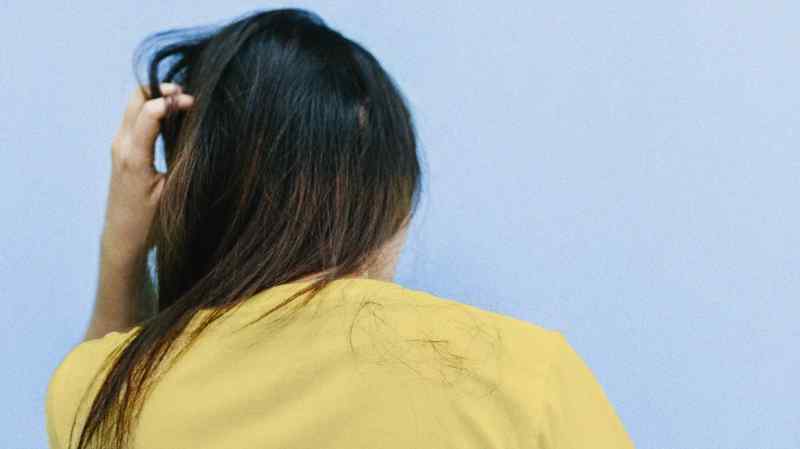 psoriasis i hovedbunden